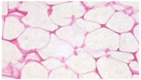 Adipose Tissue Section (H2-2)